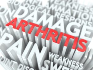 Ottawa-Glebe Chiropractor provides arthritis relief